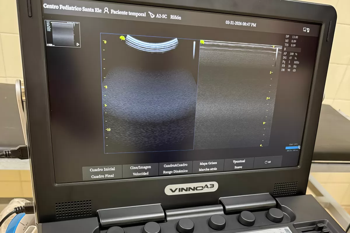 Salud incorpor&oacute; ec&oacute;grafos en tres hospitales para fortalecer la atenci&oacute;n sanitaria