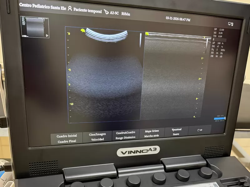 Salud incorpor&oacute; ec&oacute;grafos en tres hospitales para fortalecer la atenci&oacute;n sanitaria